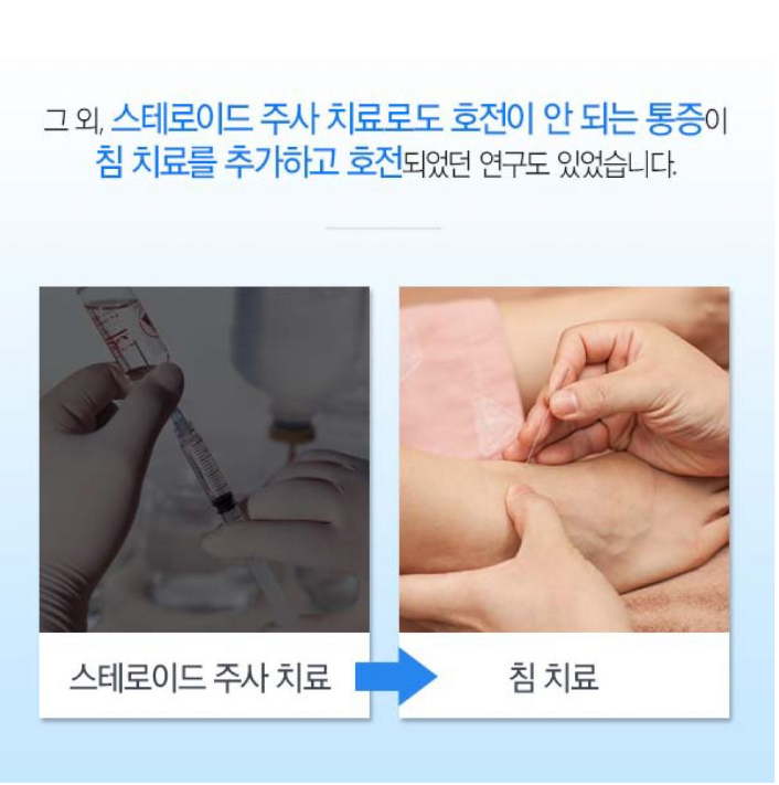 게시글 사진